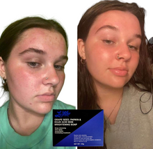 Load image into Gallery viewer, Le'Blu Grape Seed, Papaya & Kojic Acid Skin Brightening Soap (Dermatologist Recommended)